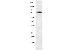 Western blot analysis of TBC1D2 using COLO205 whole cell lysates (TBC1D2 anticorps  (N-Term))