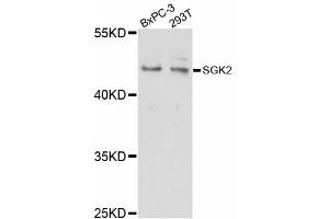 Western blot analysis of extracts of various cell lines, using SGK2 antibody (ABIN5998798) at 1/1000 dilution. (SGK2 anticorps)