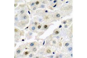 Immunohistochemical analysis of p54nrb staining in rat liver  formalin fixed paraffin embedded tissue section. (NONO anticorps)