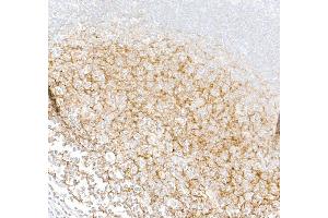 Immunohistochemistry (IHC) image for anti-Complement Component (3d/Epstein Barr Virus) Receptor 2 (CR2) (C-Term) antibody (ABIN7795815) (Recombinant CD21 anticorps  (C-Term))