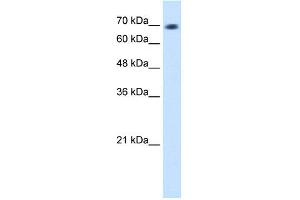 WB Suggested Anti-L3MBTL2 Antibody Titration:  1. (L3MBTL2 anticorps  (C-Term))