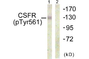 Immunohistochemistry analysis of paraffin-embedded human brain using CSFR (Phospho-Tyr561) antibody. (CSF1R anticorps  (pTyr561))