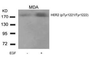 Image no. 2 for anti-Receptor tyrosine-protein kinase erbB-2 (ErbB2/Her2) (pTyr1221), (pTyr1222) antibody (ABIN196751) (ErbB2/Her2 anticorps  (pTyr1221, pTyr1222))