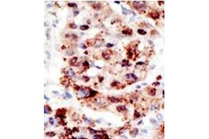 Image no. 3 for anti-Ubiquitin (Ub) (AA 44-73), (C-Term) antibody (ABIN356747)