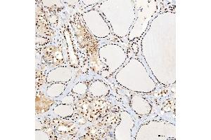 IHC analysis of SNRNP40 using anti-SNRNP40 antibody (ABIN7601719). (SNRNP40 anticorps  (AA 43-357))