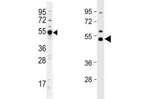 Western blot analysis of Dnmt2 antibody and different lots of mouse cerebellum lysate.
