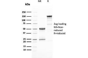 SDS-PAGE Analysis Purified HER-2 Mouse Monoclonal Antibody (ERBB2/3080). (ErbB2/Her2 anticorps  (AA 311-462))