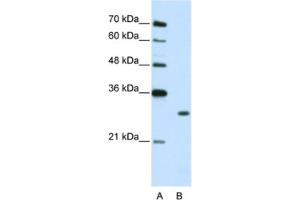 Western Blotting (WB) image for anti-Muscleblind-like Protein 1 (MBNL1) antibody (ABIN2462372) (MBNL1 anticorps)