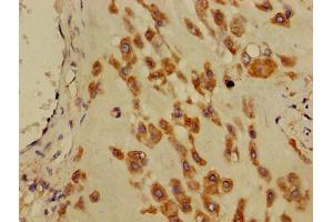 Immunohistochemistry of paraffin-embedded human placenta tissue using ABIN7150506 at dilution of 1:100 (DNAJB11 anticorps  (AA 53-238))