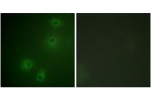 Immunofluorescence analysis of COS7 cells, using Integrin beta1 (Phospho-Thr789) Antibody.