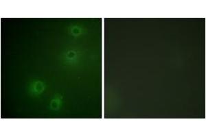 Immunofluorescence analysis of COS7 cells, using Integrin beta1 (Phospho-Thr789) Antibody. (ITGB1 anticorps  (pThr789))