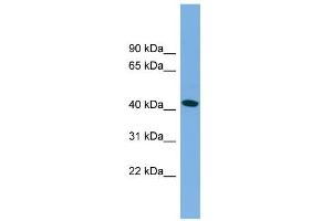 WB Suggested Anti-MAPT Antibody Titration:  0. (MAPT anticorps  (Middle Region))
