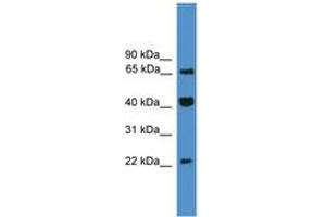 Image no. 1 for anti-Transcription Elongation Factor A (SII)-Like 6 (TCEAL6) (C-Term) antibody (ABIN6745441) (TCEAL6 anticorps  (C-Term))