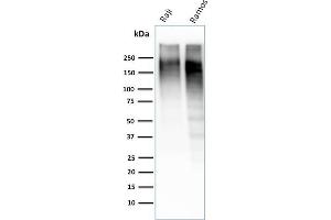 Western Blot Analysis of Raji and Ramos cell lysate using Ki67-Monospecific Mouse Monoclonal Antibody (MKI67/2462). (Ki-67 anticorps  (AA 2293-2478))