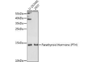 Western blot analysis of extracts of various cell lines, using Parathyroid Hormone (Parathyroid Hormone (PTH)) antibody (ABIN6128520, ABIN6146418, ABIN6146419 and ABIN6221546) at 1:1000 dilution.