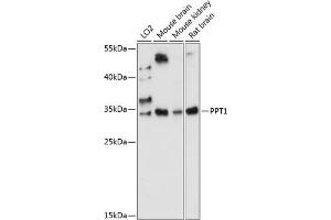 Western blot analysis of extracts of various cell lines, using PPT1 antibody (ABIN7269164) at 1:1000 dilution. (PPT1 anticorps  (AA 28-306))