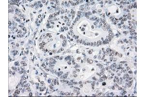 Image no. 7 for anti-Crystallin, alpha B (CRYAB) antibody (ABIN1497647)