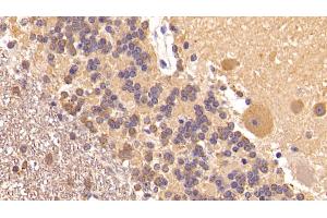 Detection of IGF1 in Human Cerebellum Tissue using Monoclonal Antibody to Insulin Like Growth Factor 1 (IGF1)