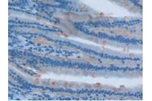 IHC-P analysis of Rat Intestine Tissue, with DAB staining. (Involucrin anticorps  (AA 461-551))