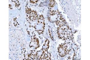 IHC analysis of SP1 using anti-SP1 antibody (ABIN7601559).