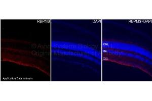 Mouse RetinaFixation of the tissues with 4 % paraformaldehyde in 0.