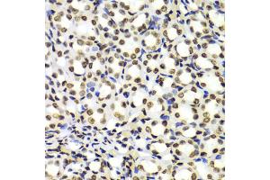 Immunohistochemistry of paraffin-embedded Rat kidney using Dimethyl-Histone H3-K4 antibody (ABIN5969803) at dilution of 1/100 (40x lens). (Histone 3 anticorps  (H3K4me2))
