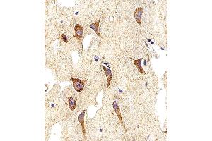 anti-Myosin (AA 654-668) antibody