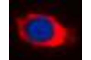 Immunofluorescent analysis of Cytochrome P450 27A1 staining in HepG2 cells.