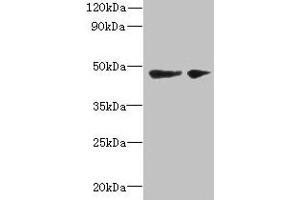Western blot All lanes: SLC25A46 antibody at 6 μg/mL Lane 1: Mouse brain tissue Lane 2: Jurkat whole cell lysate Secondary Goat polyclonal to rabbit IgG at 1/10000 dilution Predicted band size: 47, 31, 38 kDa Observed band size: 47 kDa (SLC25A46 anticorps  (AA 1-102))