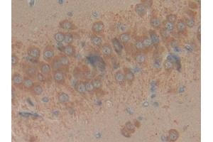 Detection of RPRM in Rat Brain Tissue using Polyclonal Antibody to Reprimo (RPRM)