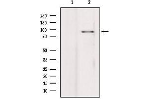 Western blot analysis of extracts from hepg2, using PIBF1 Antibody.