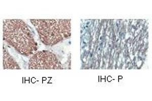 CNP antibody staining of oligodendrocyte lineage cells in the human optic nerve and/or spinal cord. (Cnpase anticorps  (Middle Region))