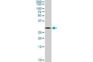 PLP1 MaxPab rabbit polyclonal antibody. (PLP1 anticorps  (AA 1-277))