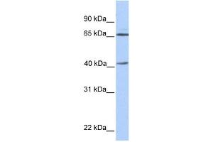 WB Suggested Anti-GLA Antibody Titration: 0. (GLA anticorps  (N-Term))