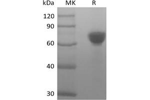Western Blotting (WB) image for Tumor-Associated Calcium Signal Transducer 2 (TACSTD2) (Active) protein (Fc Tag) (ABIN7319895)