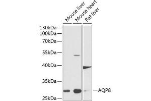 Western blot analysis of extracts of various cell lines, using  antibody (ABIN6133587, ABIN6137053, ABIN6137054 and ABIN6224632) at 1:1000 dilution. (Aquaporin 8 anticorps  (AA 50-150))