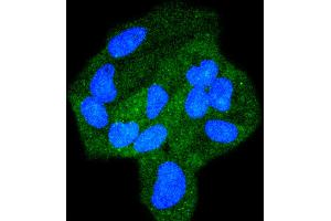 Hela cells were fixed in paraformaldehyde, permeabilized with 0.