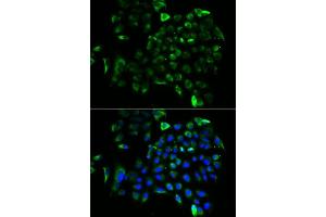 Immunofluorescence analysis of A549 cells using EEF1B2 antibody.