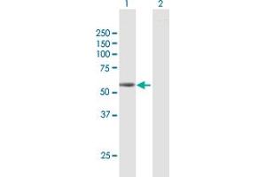 Western Blot analysis of SEMA6D expression in transfected 293T cell line by SEMA6D MaxPab polyclonal antibody.