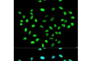 Immunofluorescence analysis of MCF-7 cells using HNRNPK Polyclonal Antibody (HNRNPK anticorps)