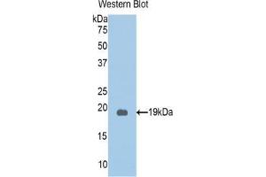 Western blot analysis of the recombinant protein. (PKN2 anticorps  (AA 323-464))