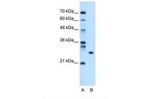 Image no. 1 for anti-RNA Binding Protein with Multiple Splicing (RBPMS) (AA 43-92) antibody (ABIN320529) (RBPMS anticorps  (AA 43-92))