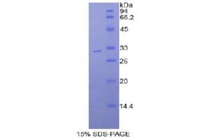 SDS-PAGE analysis of Mouse Myosin IB Protein.