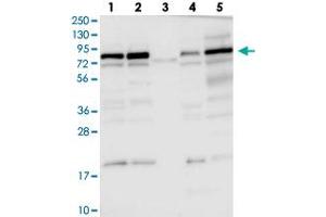 Western blot analysis of Lane 1: RT-4, Lane 2: U-251 MG, Lane 3: Human Plasma, Lane 4: Liver, Lane 5: Tonsil with DENND1C polyclonal antibody  at 1:100-1:250 dilution. (DENND1C anticorps)