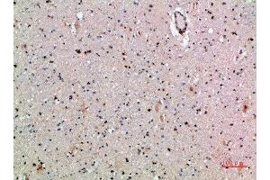 Immunohistochemical analysis of paraffin-embedded human-brain, antibody was diluted at 1:200