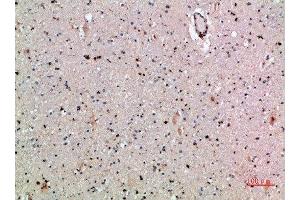 Immunohistochemical analysis of paraffin-embedded human-brain, antibody was diluted at 1:200 (CLEC4A anticorps  (AA 161-210))