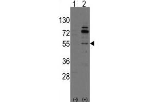 Western Blotting (WB) image for anti-Cdc42 Guanine Nucleotide Exchange Factor (GEF) 9 (Arhgef9) antibody (ABIN3001570) (Arhgef9 anticorps)