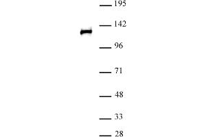POLR2B antibody (pAb) tested by Western blot. (POLR2B anticorps  (N-Term))