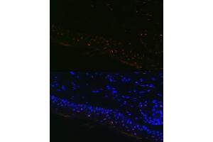 anti-Microphthalmia-Associated Transcription Factor (MITF) antibody