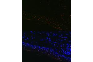 Immunofluorescence analysis of Mouse tail and ear using MITF Rabbit mAb (ABIN7268511) at dilution of 1:100 (40x lens). (MITF anticorps)